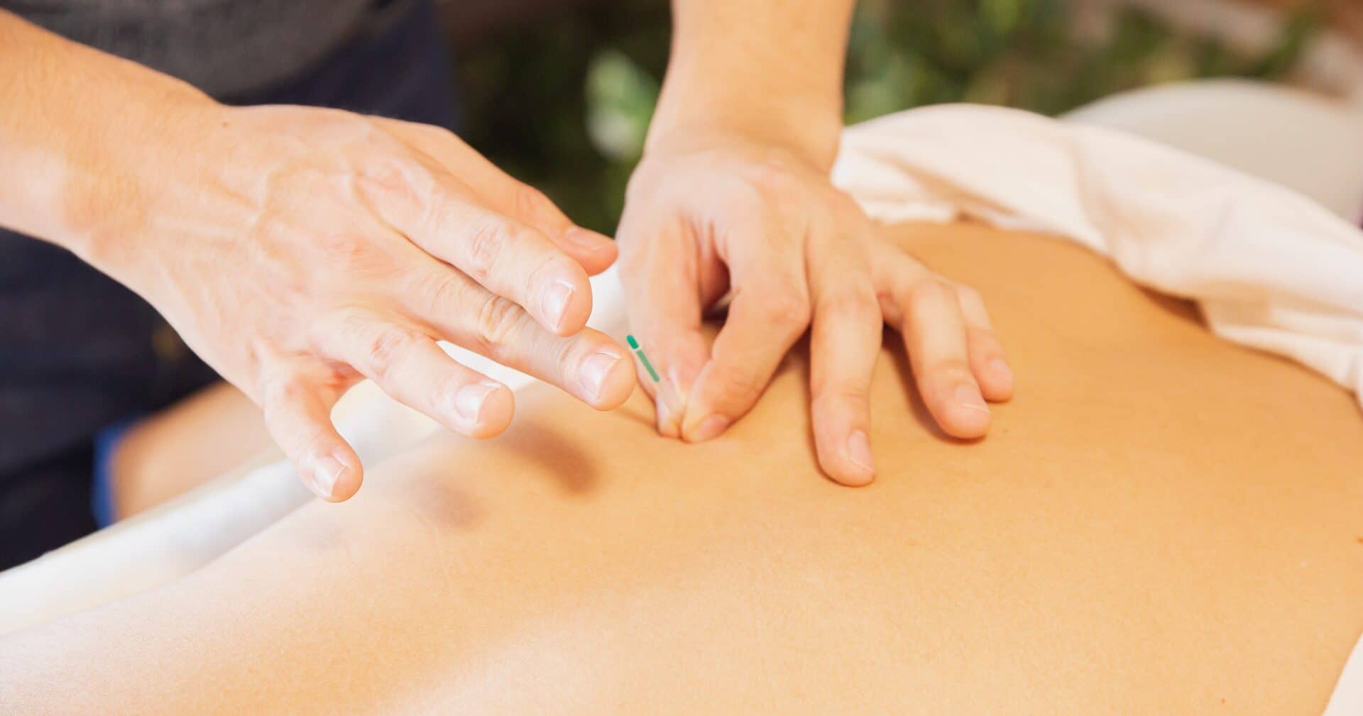 cropped-Dry-Needling.jpg